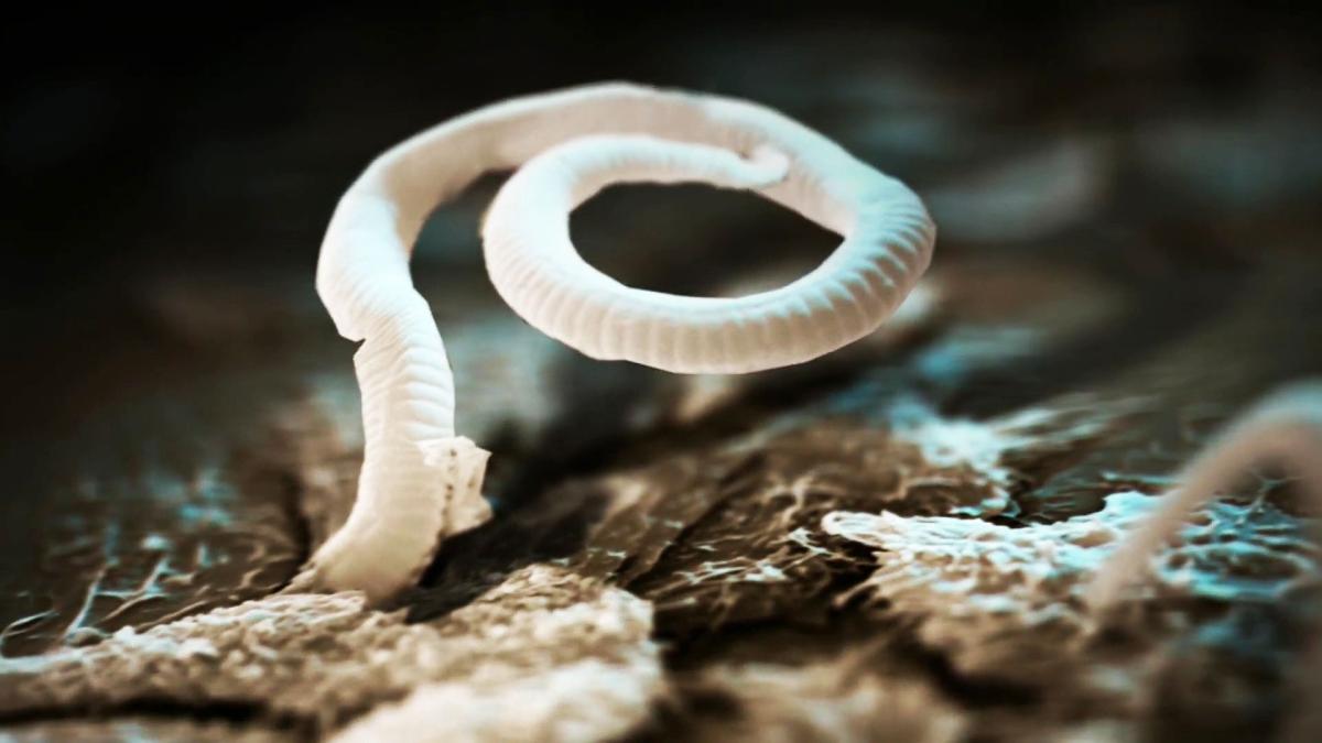 Monsters Inside Me - S2 E1 Suicide Attackers - Animal Planet GO