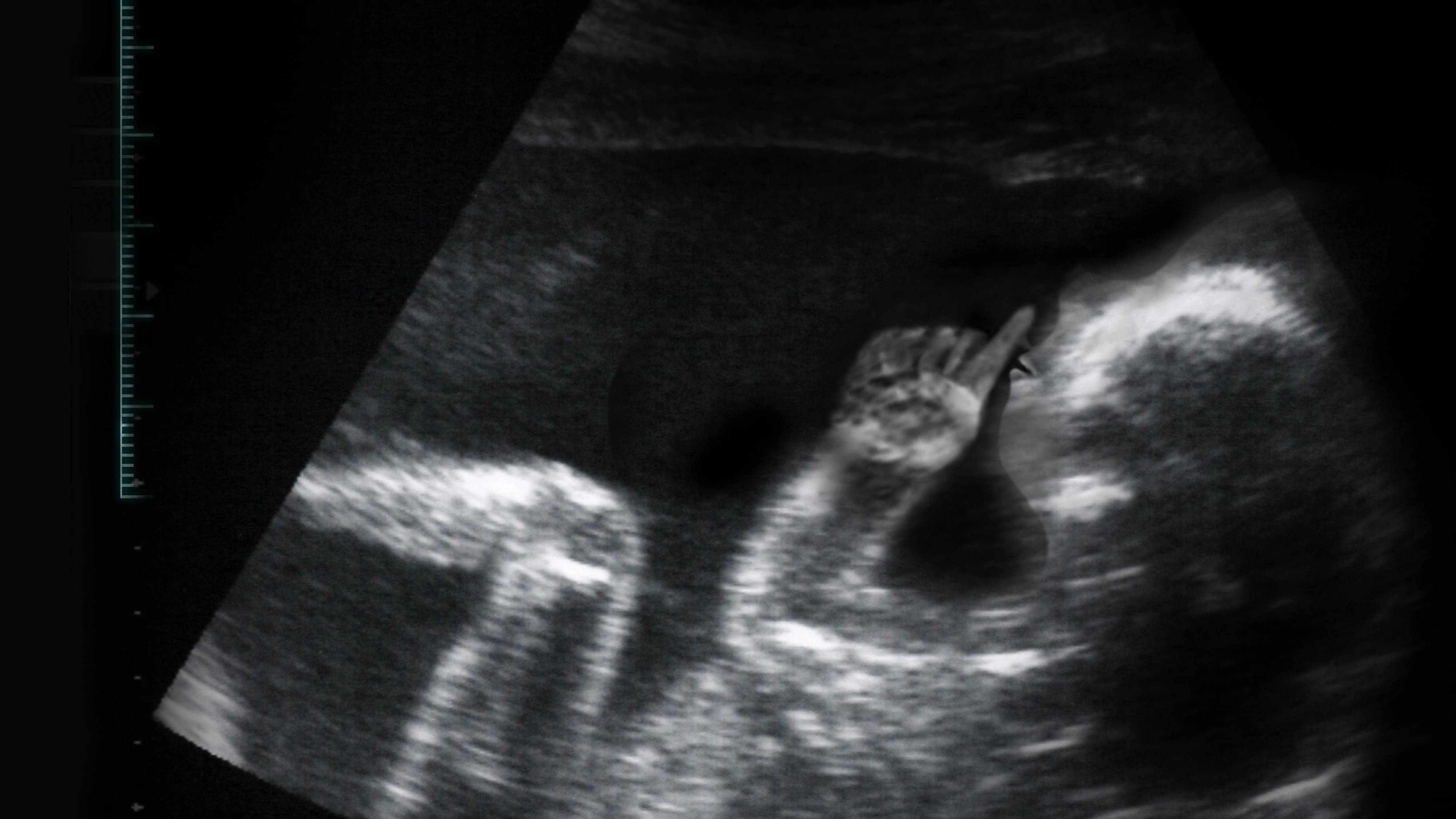 Stream Secretly Pregnant | discovery+