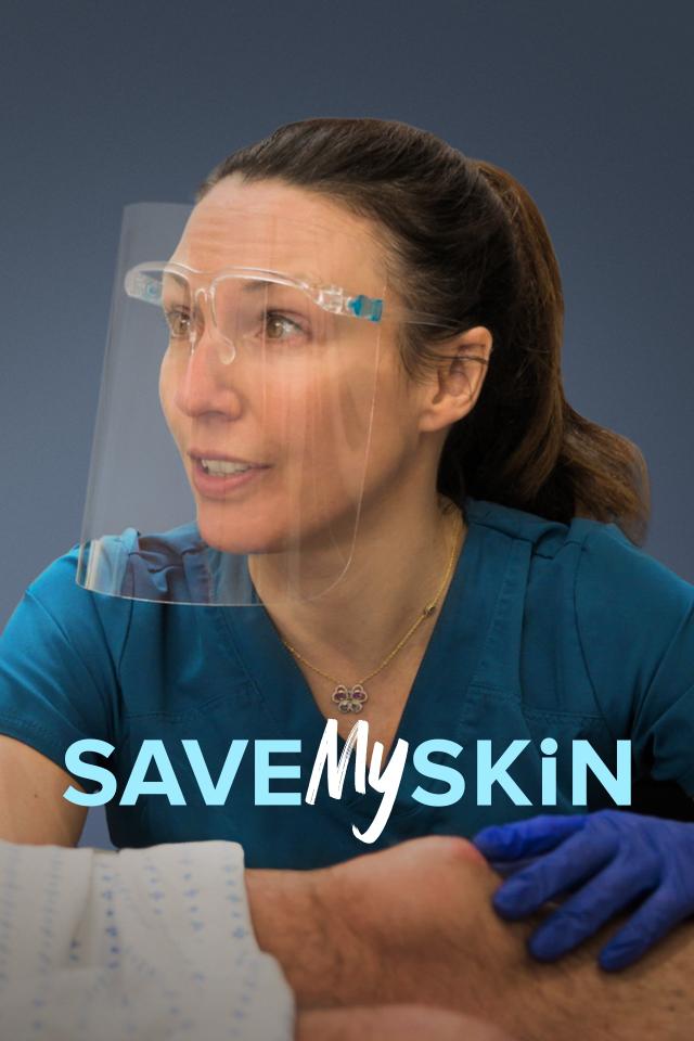 Save My Skin on FREECABLE TV